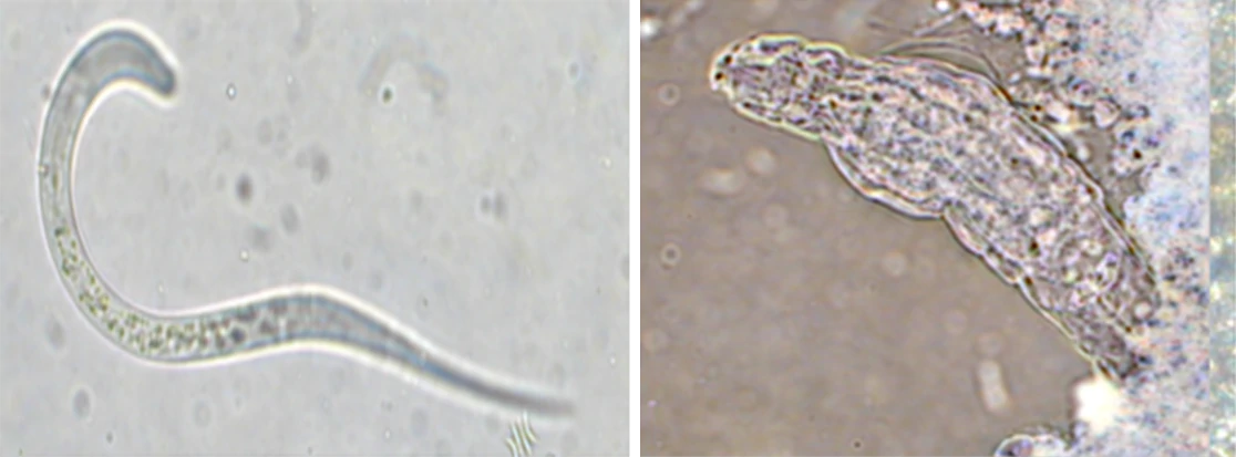 Electron microscope images